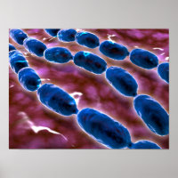 Microscopic View Of Bacterial Pneumonia 1