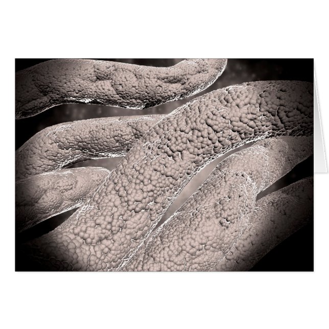 Microscopic View Of Corncob Formation (Front Horizontal)