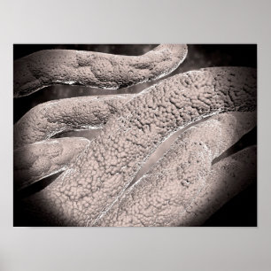 Microscopic View Of Corncob Formation Poster