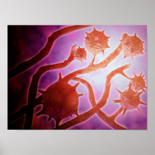 Microscopic View Of Histoplasmosis Poster