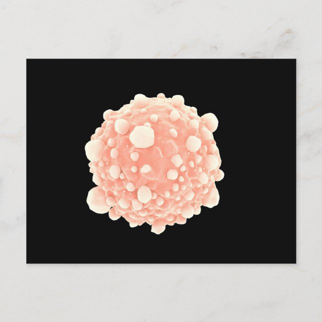 Microscopic View Of Pancreatic Cancer Cell Postcard (Front)