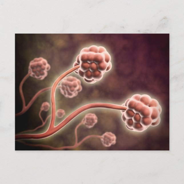 Microscopic View Of Stachybotrys Chartarum Postcard (Front)