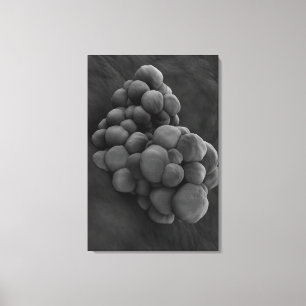 Microscopic View Of Tumour 1 Canvas Print
