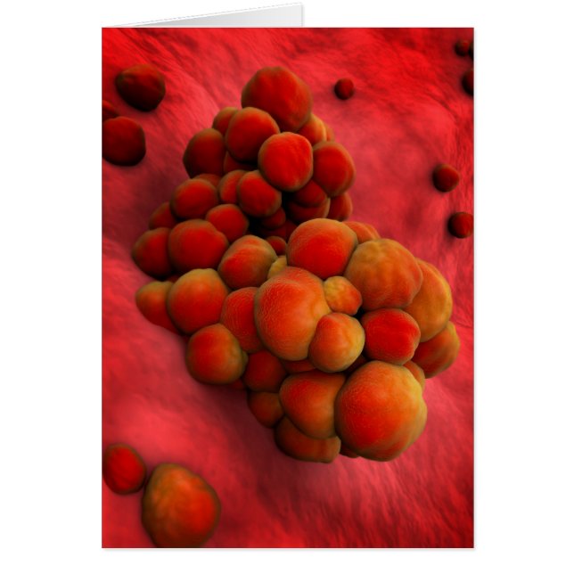 Microscopic View Of Tumour 2 (Front)