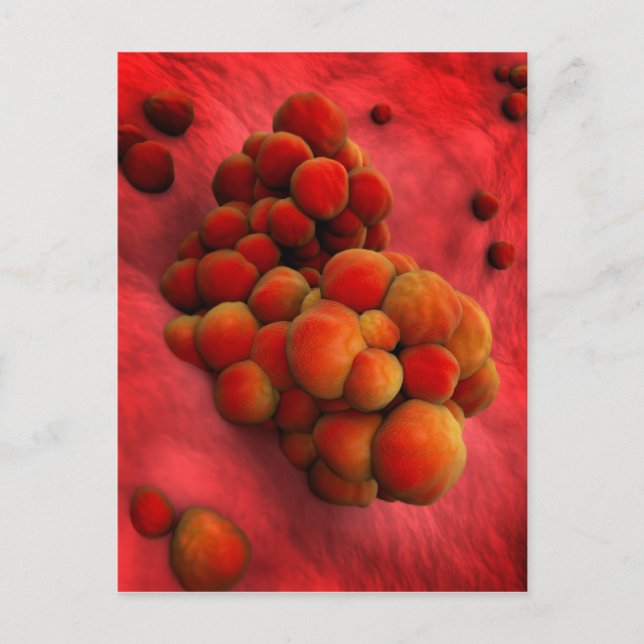 Microscopic View Of Tumour 2 Postcard (Front)