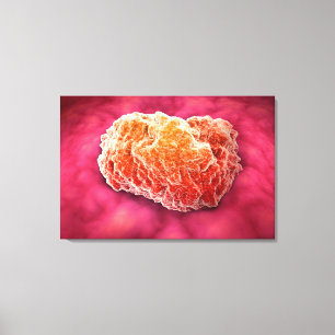 Microscopic View Of Tumour 3 Canvas Print