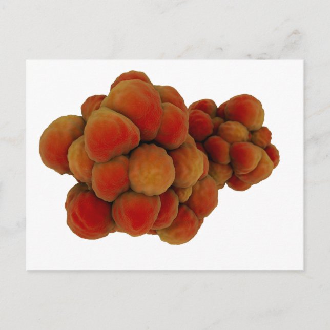 Microscopic View Of Tumour 4 Postcard (Front)