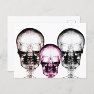 Mixed Colour X-Ray Vision Skeletons Skulls Postcard