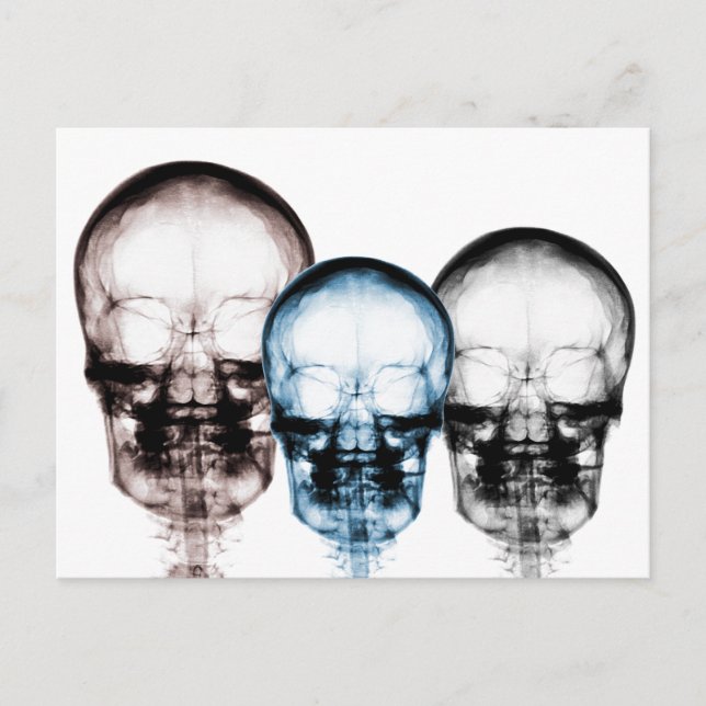 Mixed Colours X-Ray Vision Skeleton Skulls Postcard (Front)