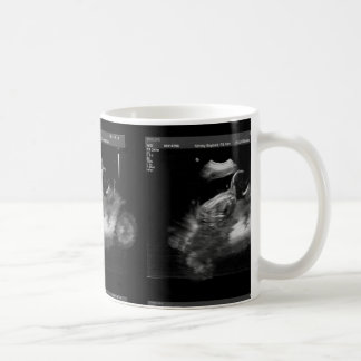 Motorcycle Sonogram Mug