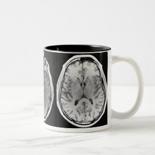 MRI brain image mug