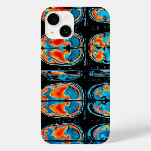 MRI brain scan Case-Mate iPhone 14 Case