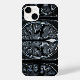 MRI brain scan Case-Mate iPhone 14 Case