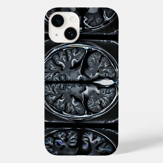 MRI brain scan Case-Mate iPhone Case (Back)