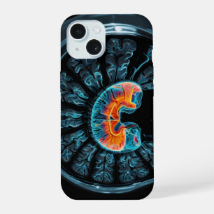 MRI brain scan iPhone 15 Case