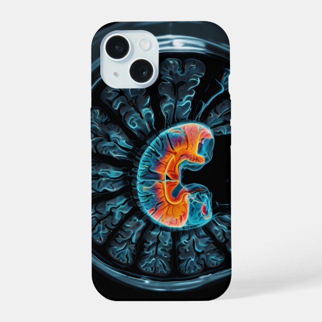 MRI brain scan iPhone 15 Case (Back)