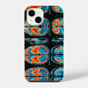 MRI brain scan iPhone 14 Case