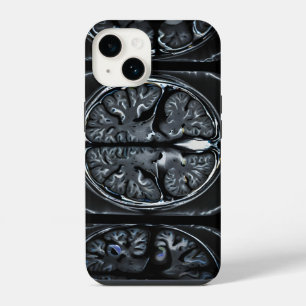 MRI brain scan iPhone 14 Case
