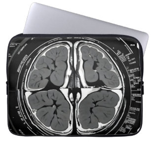 MRI brain scan Laptop Sleeve