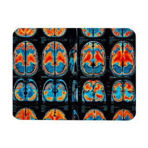 MRI brain scan Magnet