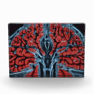 MRI brain scan Photo Block