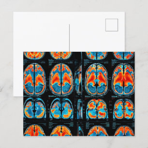 MRI brain scan Postcard