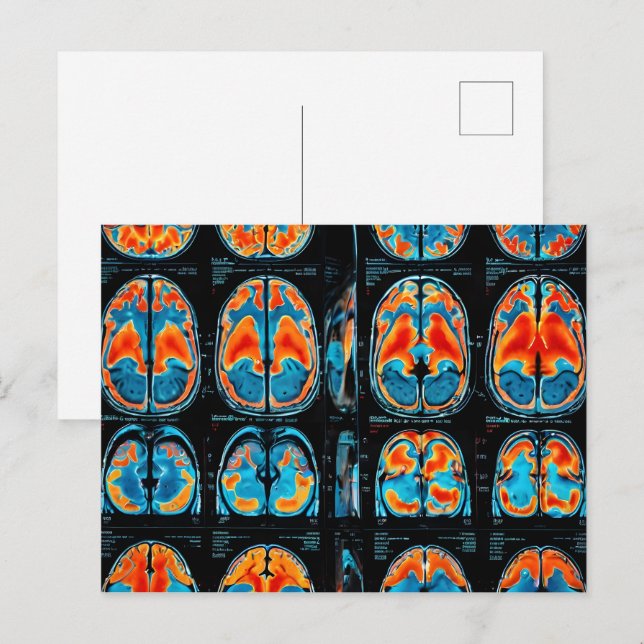 MRI brain scan Postcard (Front/Back)