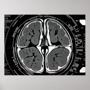 MRI brain scan Poster