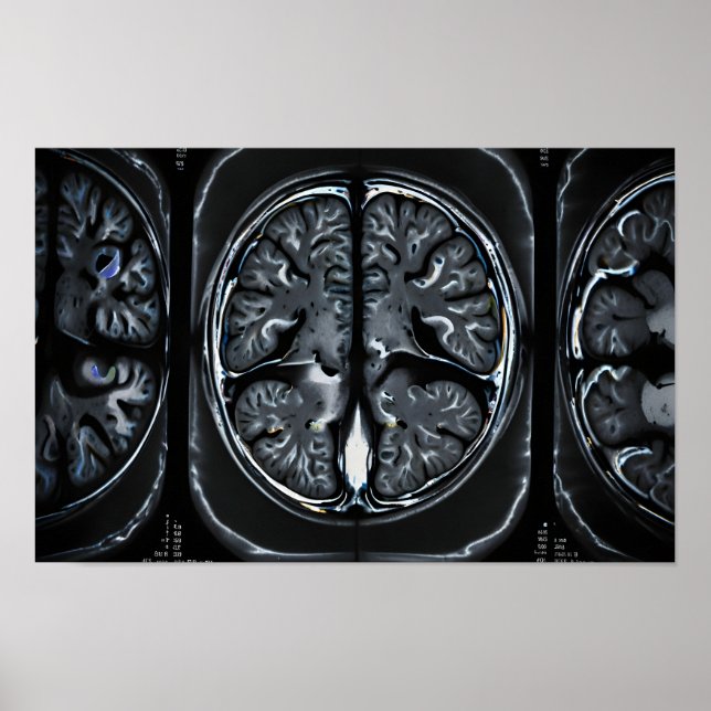 MRI brain scan Poster (Front)