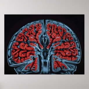 MRI brain scan Poster