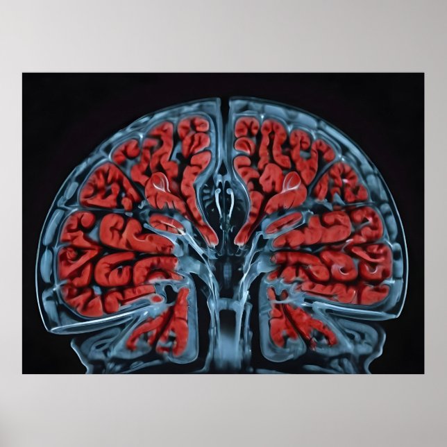 MRI brain scan Poster (Front)