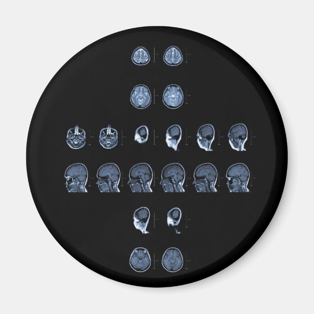 MRI Cross Magnet (Front)