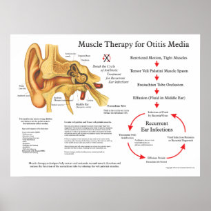Muscle Massage Therapy for Otitis Media Poster