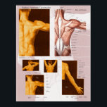Muscle Surface Anatomy Poster Back & Shoulder<br><div class="desc">Back muscles surface anatomy landmarks and motor points. The posters show the surface topography of the underlying muscles of the back and shoulder. A great reference for students and doctors to learn palpation and muscle locations. Motor points are included for the shoulder,  arm and axilla.</div>