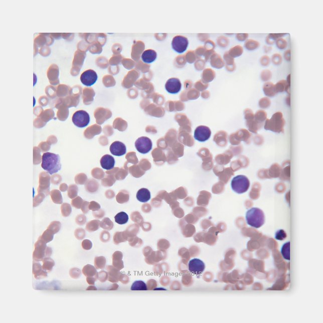 Neoplastic Lymphocyte Cells Magnet (Front)
