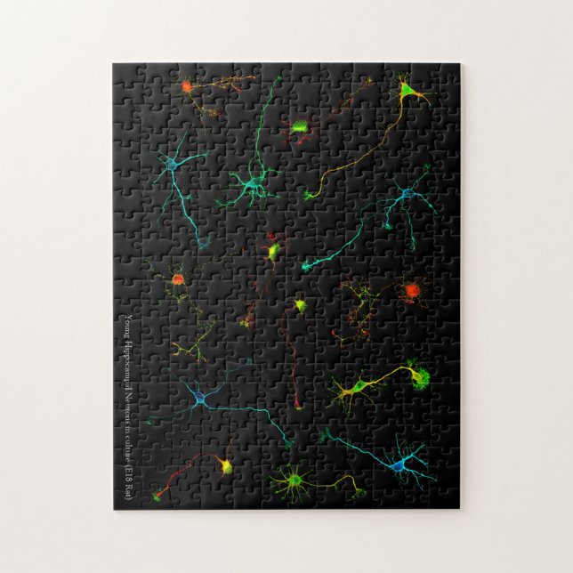 NeuroStage3 Puzzle (Vertical)