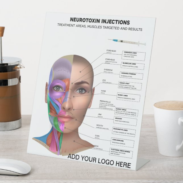 Neurotoxin Injection Points Pedestal Sign (In SItu)