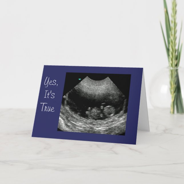 New Baby Anouncement Announcement (Front)