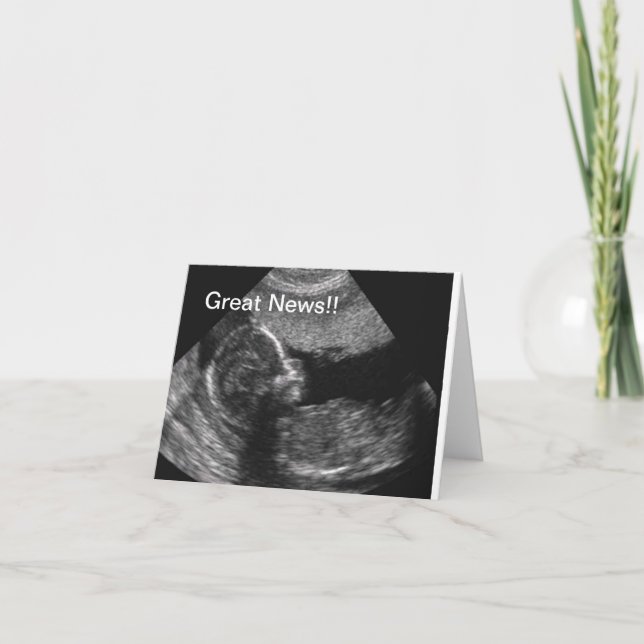 New Baby Ultrasound Announcement (Front)