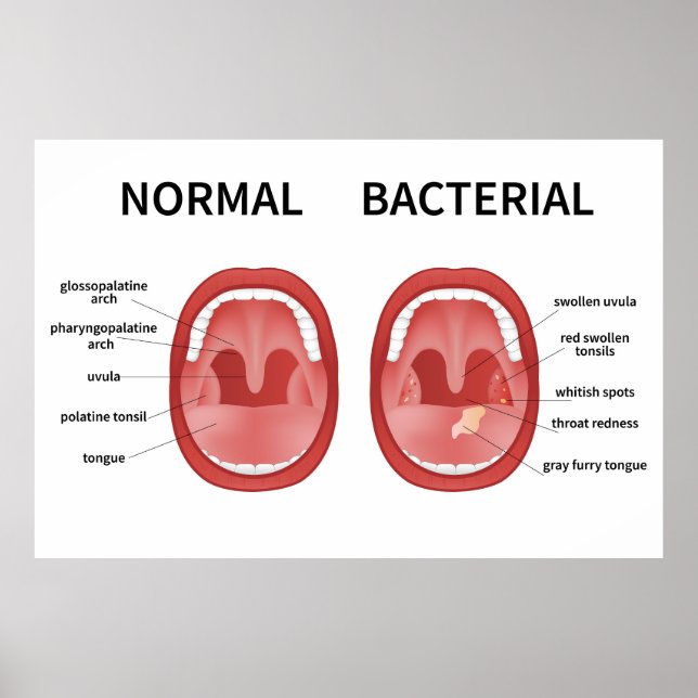 Normal Bacterial  Poster (Front)