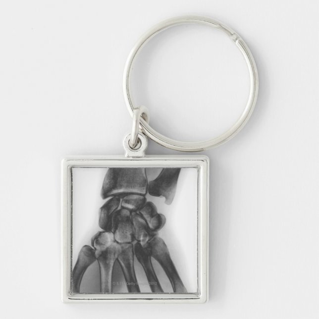 Normal wrist, X-ray Key Ring (Front)