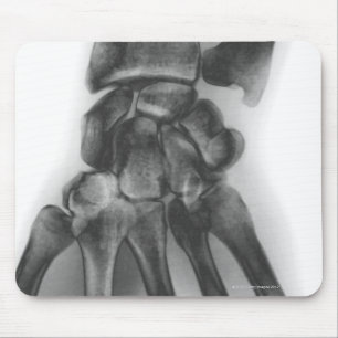 Normal wrist, X-ray Mouse Pad