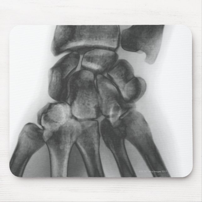 Normal wrist, X-ray Mouse Pad (Front)