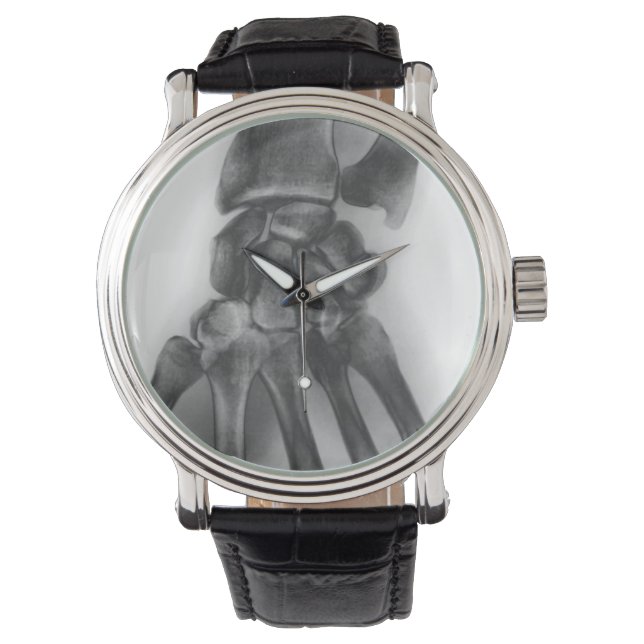 Normal wrist, X-ray Watch (Front)