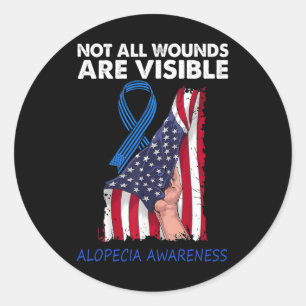 Not All Wounds Are Visible Alopecia Awareness Classic Round Sticker