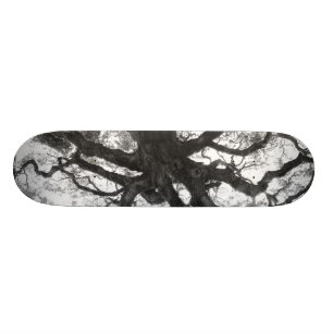 Oak Tree Skateboard