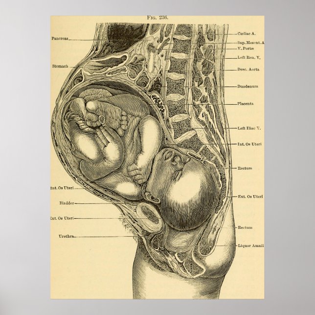 Obstetrics Illustration Poster (Front)