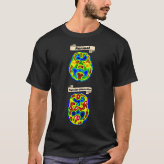 of Normal vs Bipolar brain scan T-Shirt