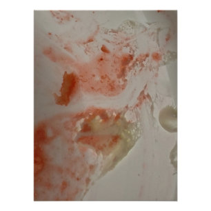 Oh My God Johnny What Happened on Your Ski Trip Poster