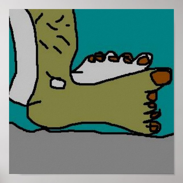 One Sunburnt Foot Poster (Front)